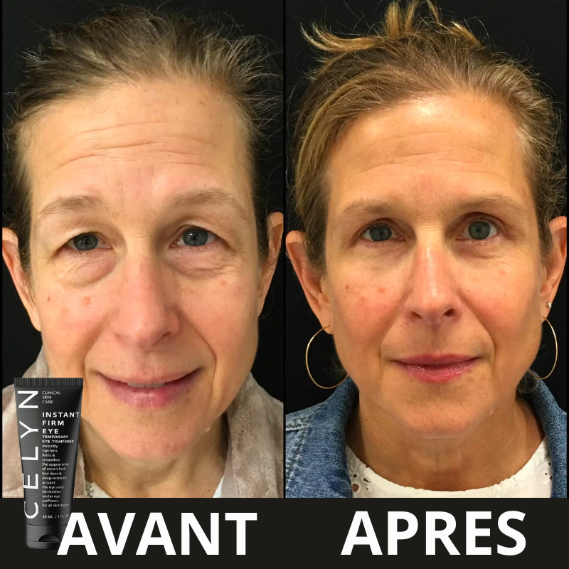 Crème Anti-Cernes et Rides instantanée : Regard Éclatant en Quelques Secondes