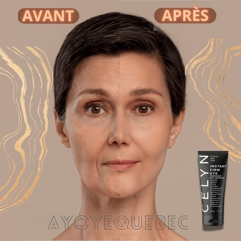 Crème Anti-Cernes et Rides instantanée : Regard Éclatant en Quelques Secondes