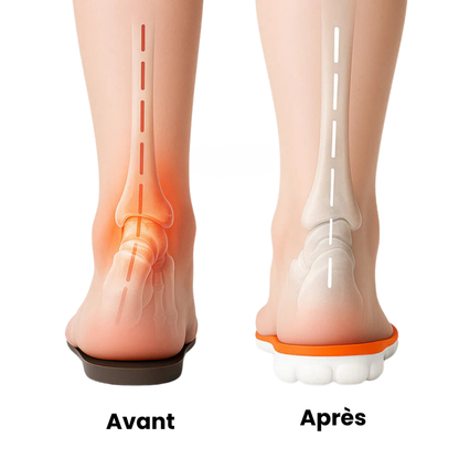 Bienpied™ – Les semelles massantes qui redonnent vie à vos pas
