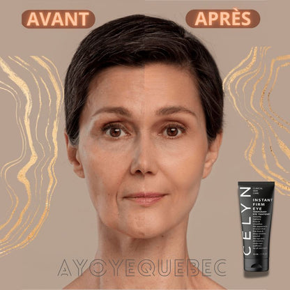 Crème Anti-Cernes et Rides instantanée : Regard Éclatant en Quelques Secondes